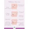 Schéma anatomique Phalloplasties homme trans