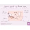 Schéma Appareil génital homme trans suite prise testostérone et hystérectom