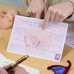 Schéma anatomique Réassignation chez une femme trans